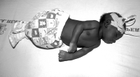 Baby in advanced stage of malaria at Garki General Hospital in Abuja, Nigeria.